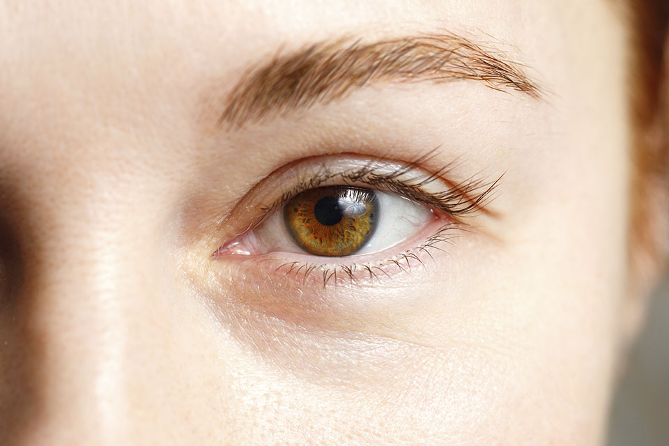 Ojos
