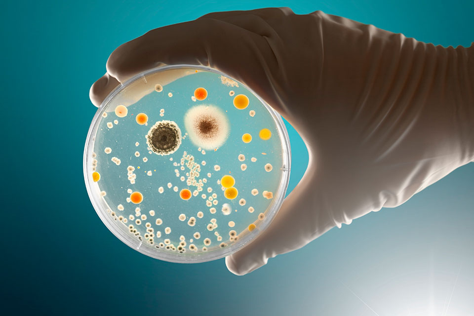 Placa-con-bacterias
